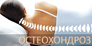 Остеохондроз Остеохондроз