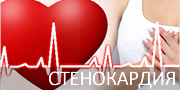 Стенокардия и инфаркт. Советы Стенокардия и инфаркт. Советы