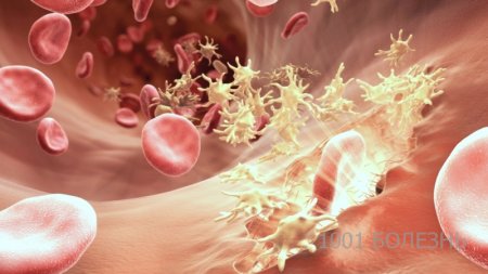 Гемофилия. Симптомы гемофилии, диагностика, профилактика и лечение. Отзывы.